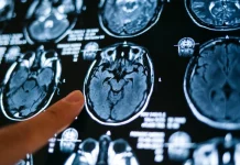 Avem, din naștere, în corpul nostru acel „ceva” care ne-ar putea ține departe de Alzheimer